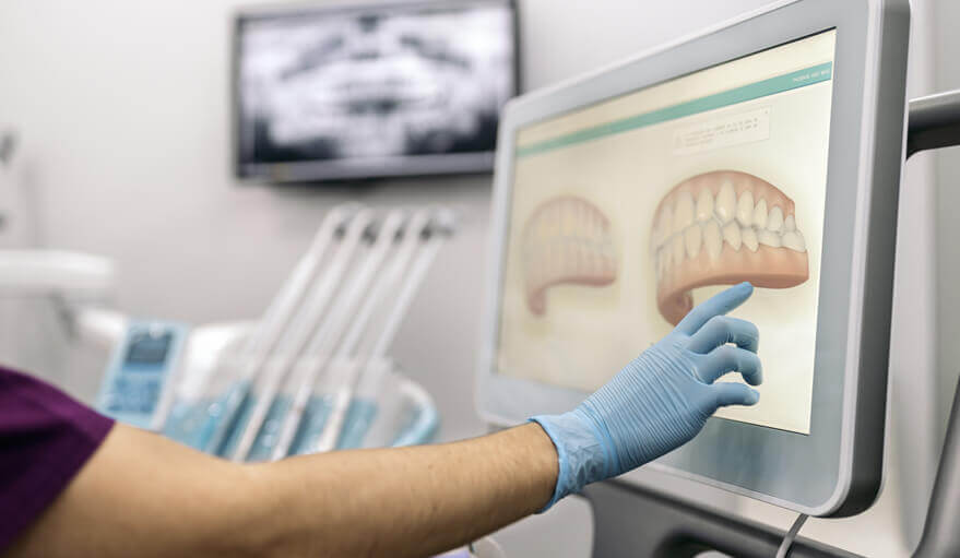 technology/digital-impressions-laser-dentistry.jpg